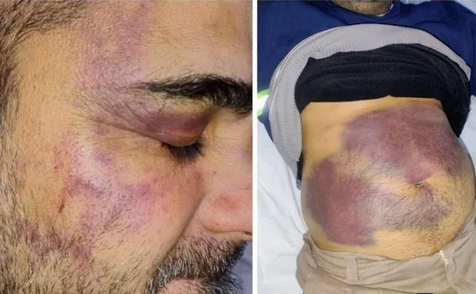 Denuncian torturas en la Comisaría de Ulapes: reclaman acciones políticas inmediatas